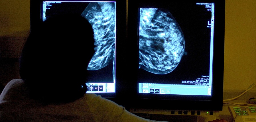 زنان مبتلا به سرطان سینه باید به مدت ۱۰ سال دارو مصرف کنند