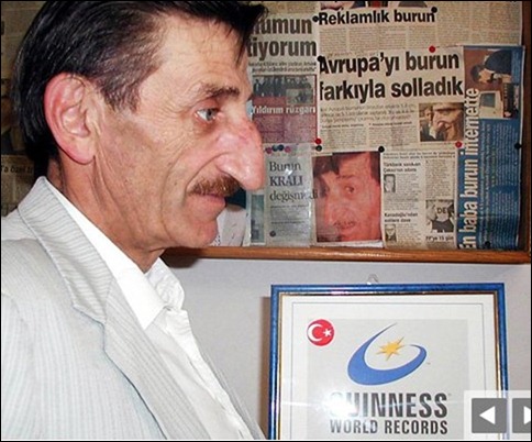 «مهمت اوزیورک» در سال 1949 در ترکیه به دنیا آمده است و در سال 2007 رکود دار بلندترین بینی در جهان به شمار می رفت. بینی وی 8.8 سانتی متر بود. اما مرد پاکستانی تبار دیگری به نام «فایضن آقا» توانست با بینی 12.19 سانتی متری خود، رکود وی را شکسته و نام خود را در کتاب گینس ثبت کند. 