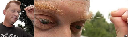 «فرانک آمس» در سال 2013 توانست با موهای 9.6 سانتی متری ابروهای خود، نامش را در گینس ثبت کند. 
