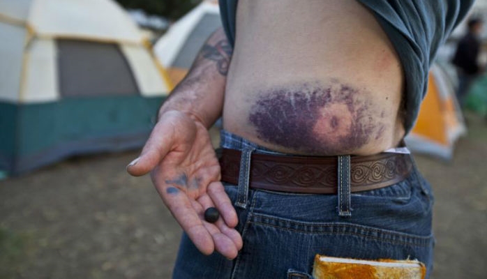 PIC of rubber bullet wound by guy helping scott olsen-w700