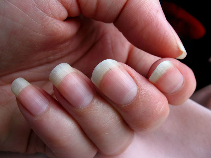 fingernails-inline-w700