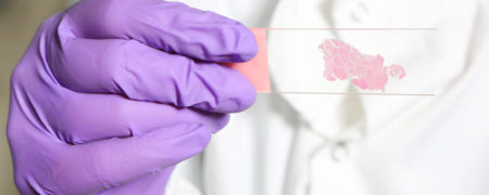 نخستین عامل مرگ و میر در آمریکا تغییر یافت