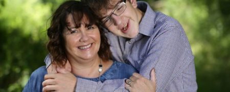 ۱۵۸ جراحی صورت طی ۱۸ سال؛ پسری با روحیه فولادی