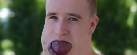 پسری لهستانی که زبانی عجیب و به اندازه یک توپ تنیس دارد