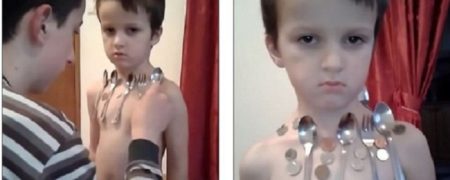 انسان آهن ربائی؛ پسر ۵ ساله ای که بدنش قدرت جذب فلزات را دارد [تماشا کنید]