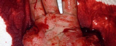 گریم های خونین و وحشتناکی که یک دختر ۱۷ ساله روی اعضای بدن خود اعمال می کند [تماشا کنید]