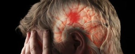 آیا سکته کرده ایم؟ نشانه های سکته که از آنها غافل هستیم چه هستند؟