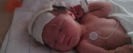 نوزادی که با حفره ای روی سر متولد شده و مغزش قابل مشاهده است