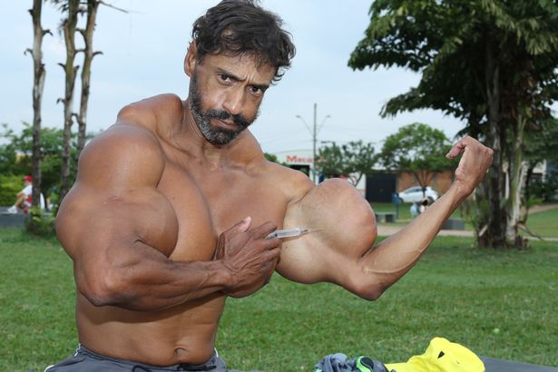 valdir-injects-synthol-into-his-bicep