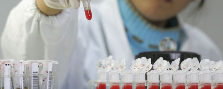 افزایش امیدها برای درمان «HIV»؛ روش جدید توانست بیماری فرد انگلیسی را کاملا بهبود ببخشد