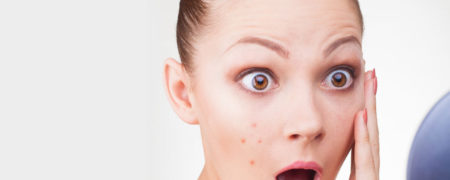 جوش زدن چه دلایلی دارد و چگونه می توان از آن پیشگیری کرد؟ [تماشا کنید-زیرنویس فارسی]