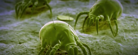 نگاهی به دنیای پنهان حشرات میکروسکوپی که در رختخواب شما زندگی می کنند [تماشا کنید-زیرنویس فارسی]