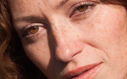 ۵ راهکار خانگی و ۲ راهکار پزشکی برای رفع لک های تیره پوست