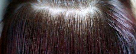 دو تست ساده برای اینکه متوجه شوید ریزش موهای شما طبیعی هست یا خیر