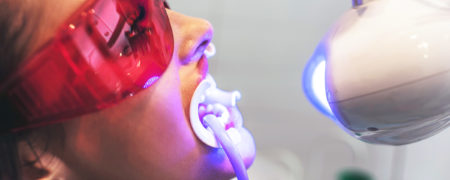 قبل از «بلیچینگ» یا سفیدکردن دندان ها لازم است به چه نکاتی توجه کنیم؟