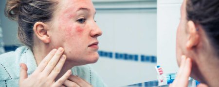 مراقبت هایی که افرادی با پوست های حساس تر باید انجام دهند