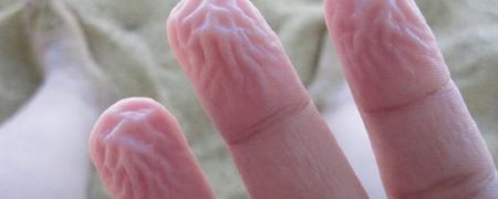 9 واکنش بسیار عجیب و جالب بدن انسان که احتمالاً دلیل آن ها را نمی دانید