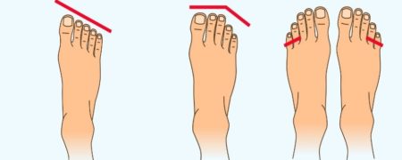 شکل انگشتان پا چه رازی را در مورد شخصیت شما بر ملا می کند؟