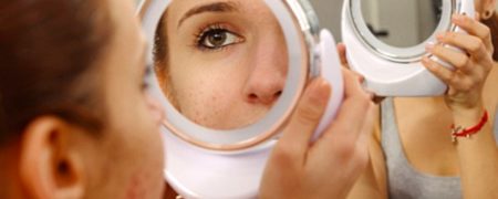 دلایل ظاهر شدن آکنه بر روی پوست صورت و روش های درمان آن