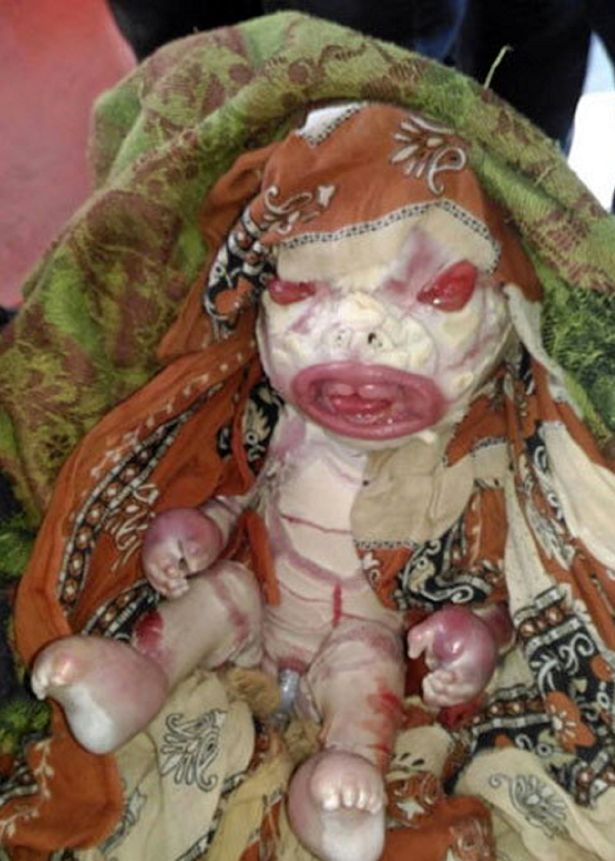 PAY-Strange-alien-baby-born-in-India (1)