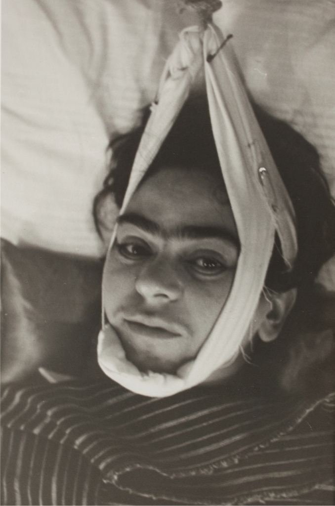 فریدا کالو (نقاش مکزیکی و یکی از زنان نامدار تاریخ هنر معاصر است) در بستر بیماری - 1940