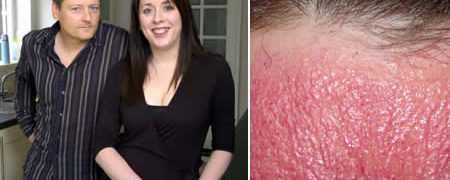 ۹ فردی که بیماری های عجیب و نادرشان شما را شگفت زده می کند