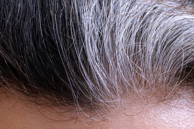 سفید شدن موها، چه نکاتی را در مورد سلامتی تان آشکار می سازند