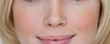 ۸ واقعیت تعجب برانگیز در مورد «سرطان پوست» که هر فردی باید از آنها آگاهی داشته باشد