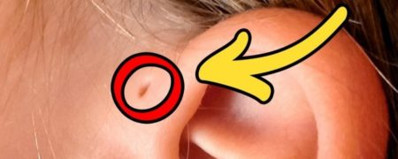10 ویژگی منحصر به فرد بدن انسان که تنها در ۵ درصد کل افراد جهان وجود دارند