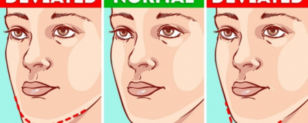 آنچه شکل چانه تان در مورد وضعیت سلامتی شما می گوید