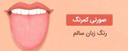 آنچه رنگ زبان و پوشش خارجی آن در مورد وضعیت سلامتی تان می گویند