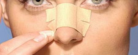 عمل بینی، تغییرات ناخواسته دیگری را نیز در صورت افراد به وجود می آورد