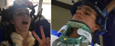 عجیب و باور نکردنی؛ با زنی آشنا شوید که به خاطر عطسه گردنش شکست