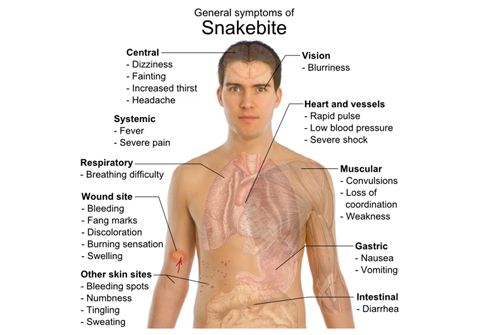 Snake-bite-symptoms