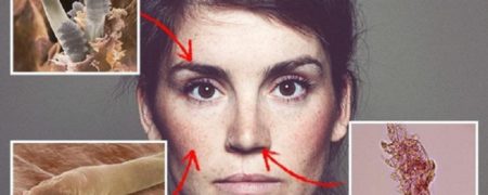 با انگل های ترسناکی آشنا شوید که هم اکنون آزادانه روی صورت شما زندگی می کنند