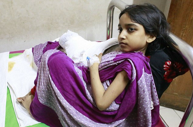 داستان موکتامونی؛ دختر بنگلادشی ۱۲ ساله ای که به بیماری نادر «مرد درختی» مبتلا شده است