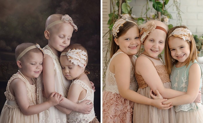 نگاهی به عکس های قبل و بعد کسانی که با سرطان مبارزه کردند