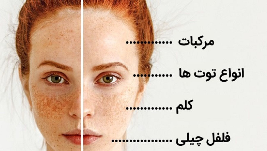 با ۱۱ راز تغذیه از زبان متخصصان آشنا شوید که موجب زیبایی بیشتر پوست می شوند