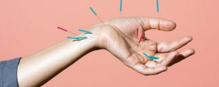 موثر بودن طب سوزنی در آزاد کردن تسکین دهنده های درد در بدن تایید شده است