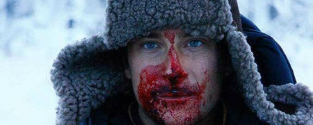 هماتوهیدروزیس؛ بیماری نادر و عجیبی که در آن بیمار خون عرق می کند