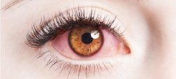 چرا چشم ها قرمز می شوند و چگونه می توان آن ها را درمان کرد؟