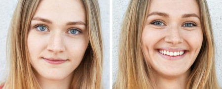 ۱۳ نوع جراحی زیبایی غیرمعمول که بزودی رایج خواهند شد