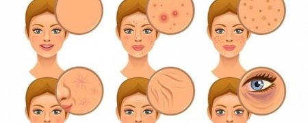 ۶ غذایی که سبب بروز پیری زودرس و ایجاد اکنه در پوست می شوند