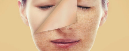 چطور در زمستان از خشک شدن و خارش گرفتن پوست خود جلوگیری کنیم؟