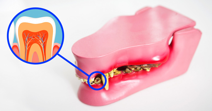 رشد دندان با سلول‌های بنیادی