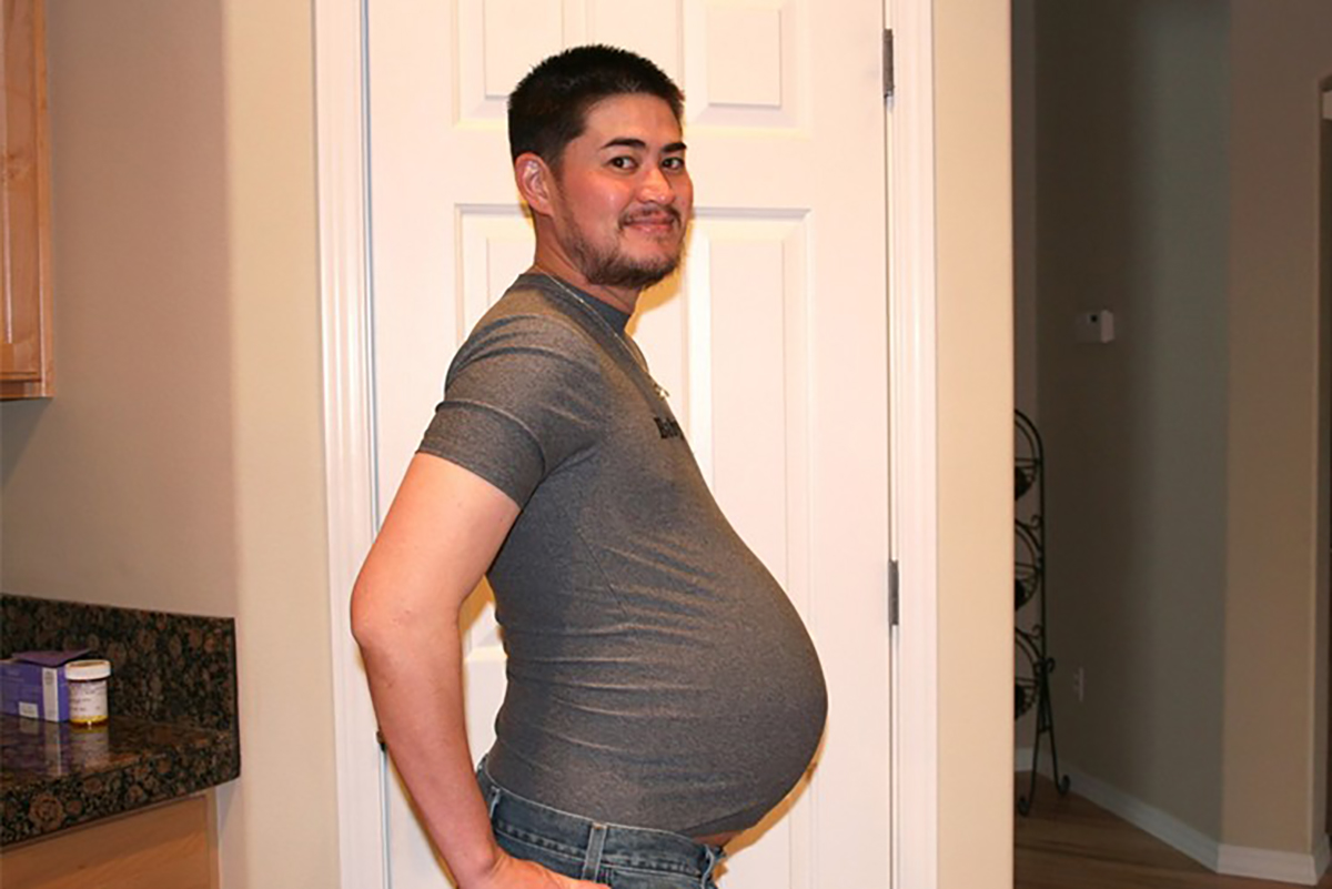 مردانی که باردار شدند و زایمان کردند؛ با ۵ مورد از عجیب‌ترین بارداری‌های جهان آشنا شوید