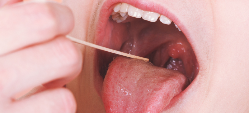 بیماری های دهان و حلق