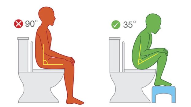 کدام توالت برای سلامتی ما بهتر است؛ فرنگی یا سنتی؟7