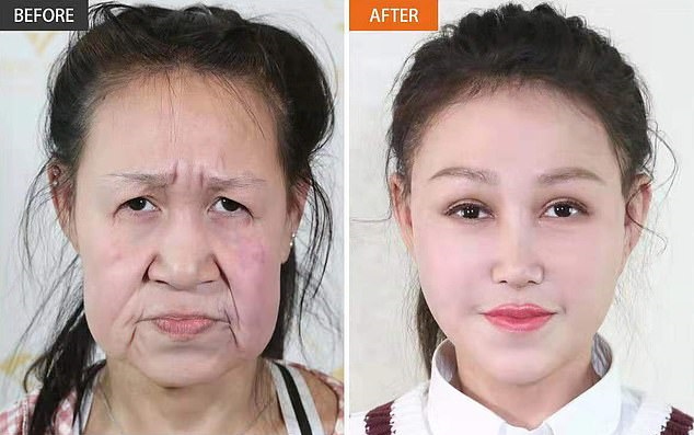 یک دختر 15 ساله چینی که به خاطر ابتلا یک بیماری نادر، چند دهه مسن تر از سن واقعی اش به نظر می رسید، طی یک جراحی زیبایی تاریخ ساز ظاهر جدیدی پیدا کرده است.