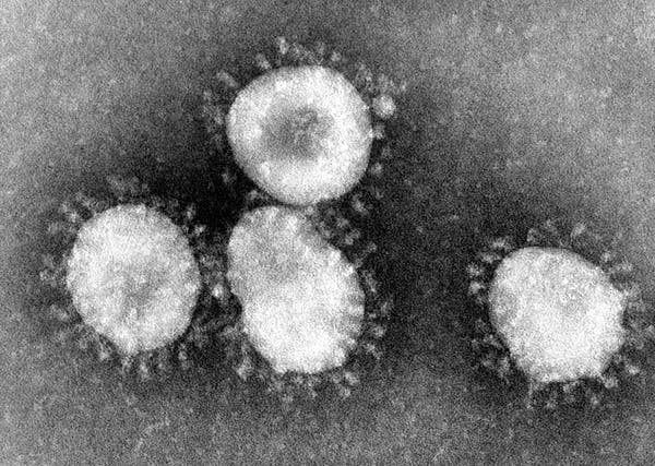 نمونه جدید کروناویروس (coronavirus) که هنوز نامی ندارد باعث ایجاد نشانه هایی شبیه سرماخوردگی مانند آبریزش بینی، سردرد، سرفه، گلو درد و تب در فرد می شود.